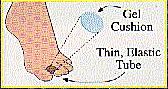 Toe Pad